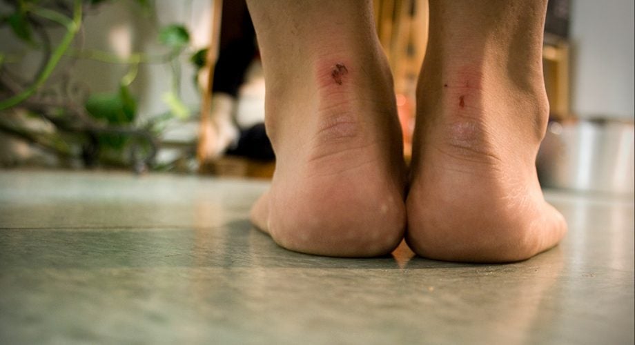 A Runner's Foot Pain Speaks Truth