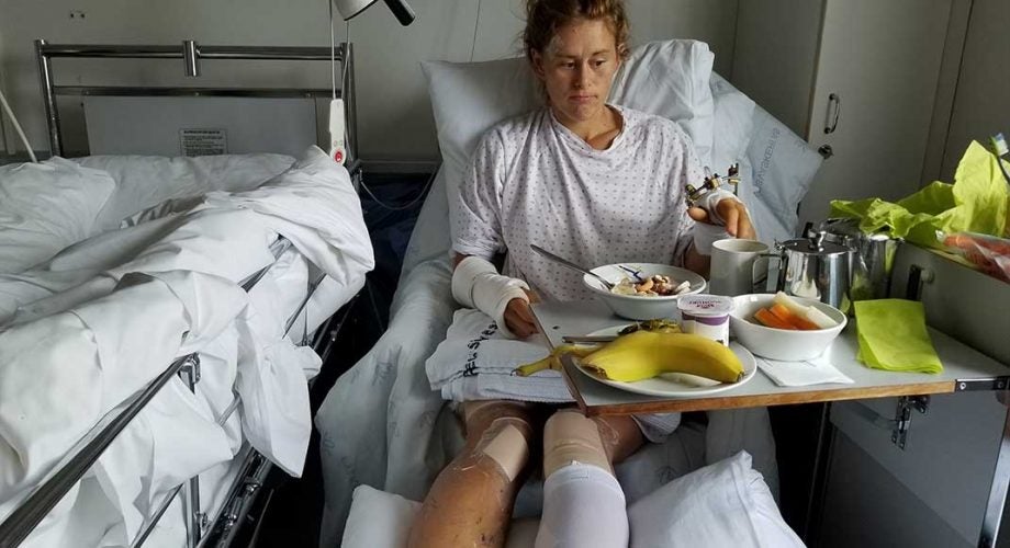 After Near-Fatal Fall, Hillary Allen Finds Strength in Silver Linings